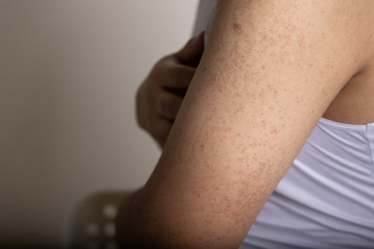 image of bumpy skin on the back of a human arm